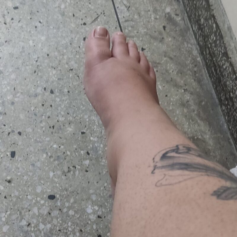 Carnaval Walfredo Gurgel