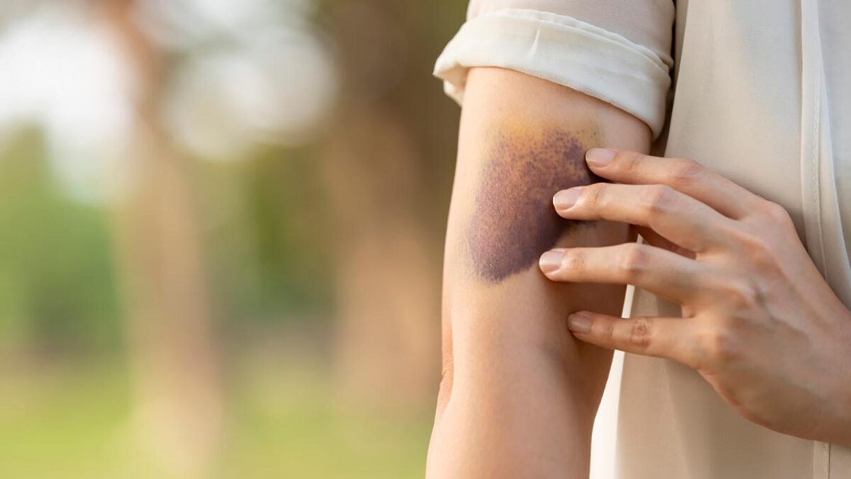 leucemia Rio Grande do Norte